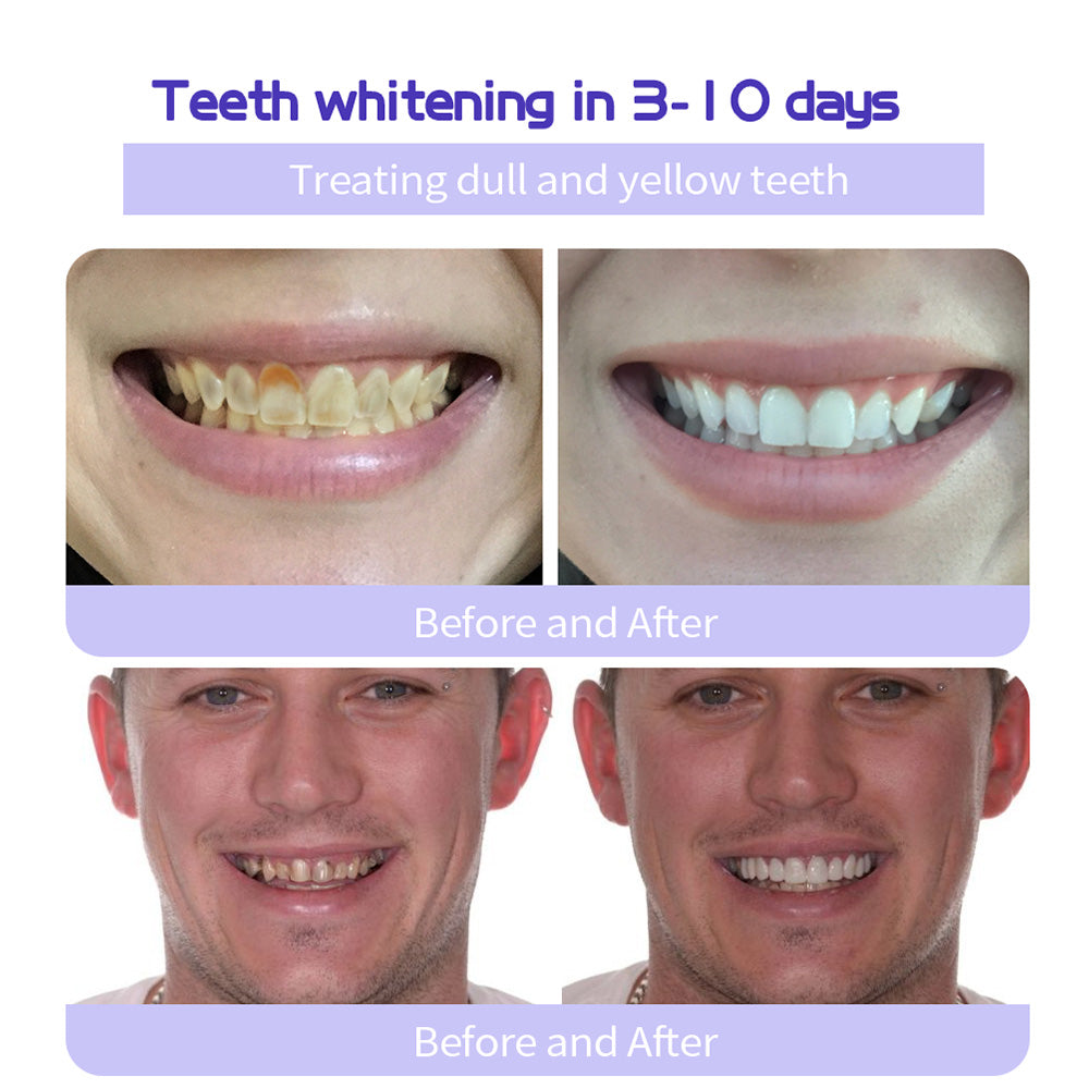 👩⚕️ADA-CERTIFIED: Lenaro® Teeth Restoration Mineral Tablets-🦷 Recommended by the American Dental Association (effectively repairs cavities, gum issues, tooth sensitivity, mouth ulcers, yellowing teeth, and improves oral health)🌈🌈
