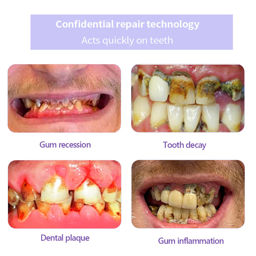👩⚕️ADA-CERTIFIED: Lenaro® Teeth Restoration Mineral Tablets-🦷 Recommended by the American Dental Association (effectively repairs cavities, gum issues, tooth sensitivity, mouth ulcers, yellowing teeth, and improves oral health)🌈🌈