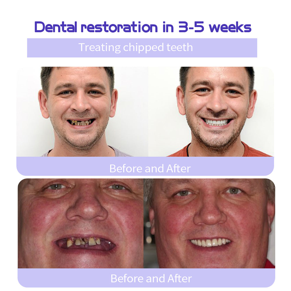 👩⚕️ADA-CERTIFIED: Lenaro® Teeth Restoration Mineral Tablets-🦷 Recommended by the American Dental Association (effectively repairs cavities, gum issues, tooth sensitivity, mouth ulcers, yellowing teeth, and improves oral health)🌈🌈