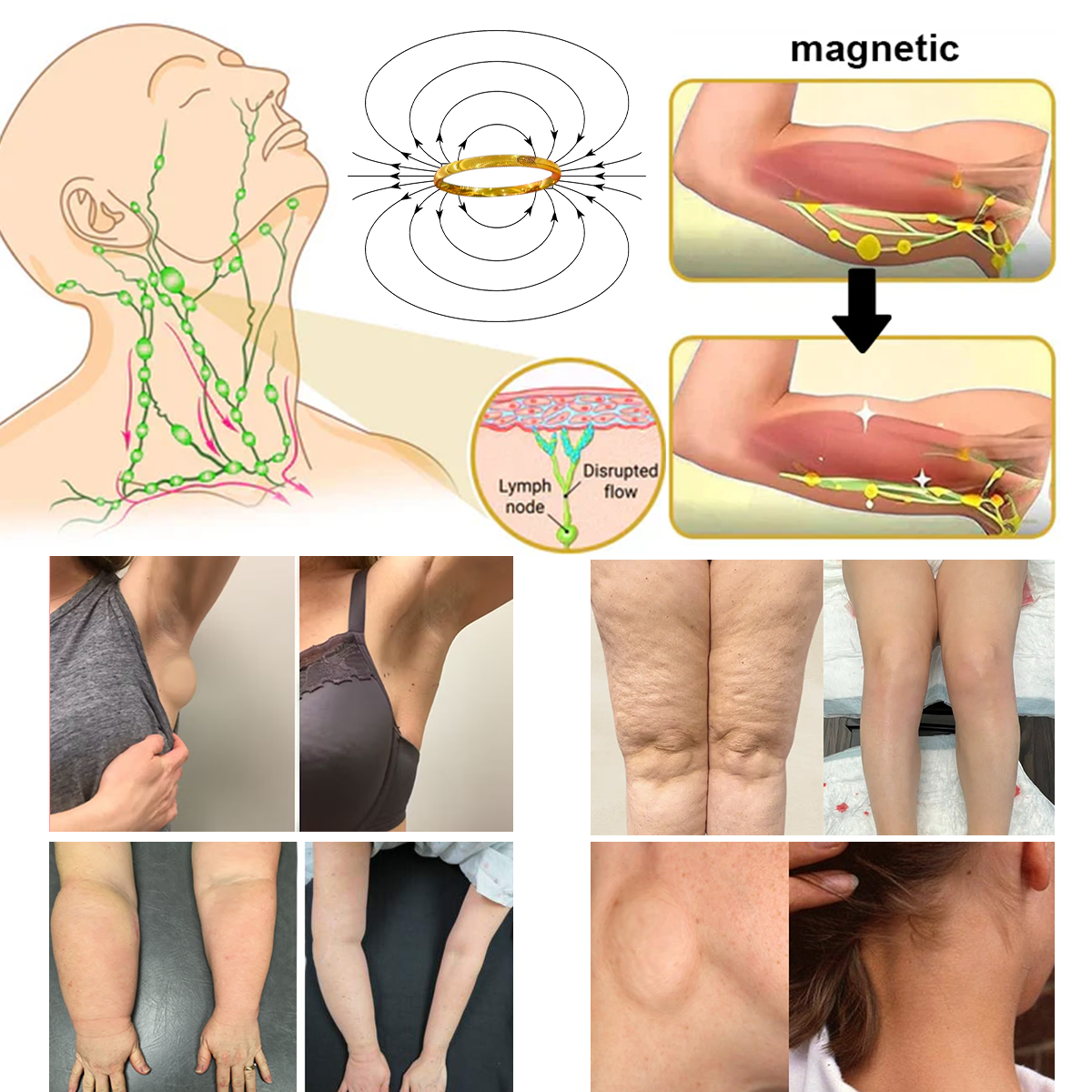 Last Day Promotion 80% OFF š„CZTICLE Lymphatic Magnetic Therapy Catās Eye Ringš„