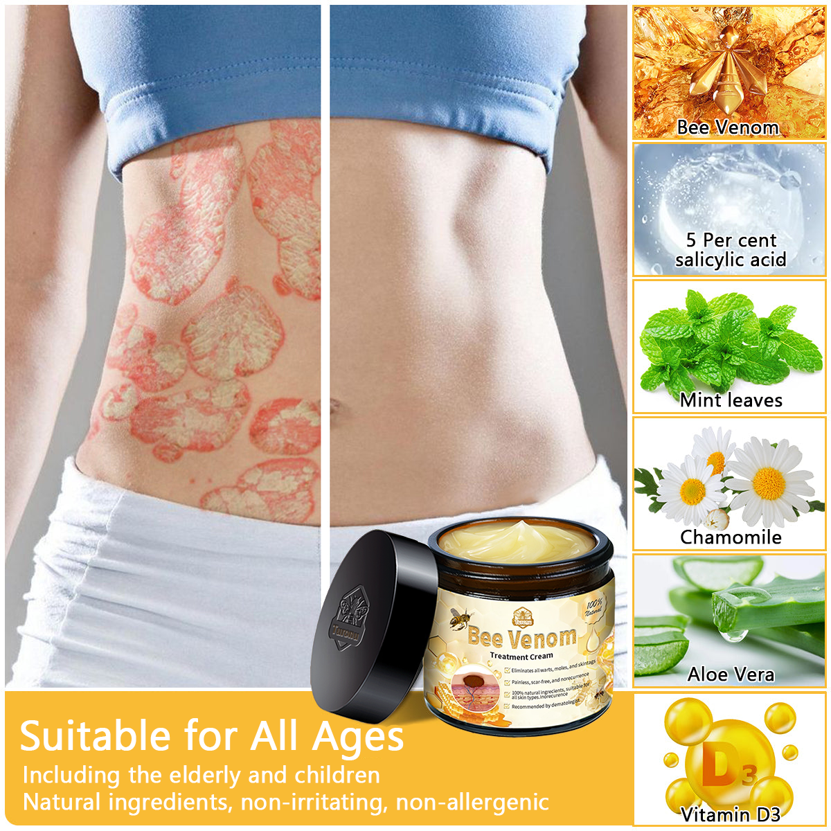 ๐๐๐๐ข๐๐๐๐ขโข Bee Venom Skin Treatment Cream๏ผ๐ด๐ด๐ท ๐
๐๐๐๐๐๐๐๐๐๐๏ผ๐