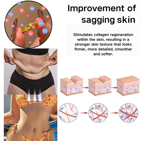 Last Day Promotion 80% OFF š„CZTICLE Lymphatic Magnetic Therapy Catās Eye Ringš„