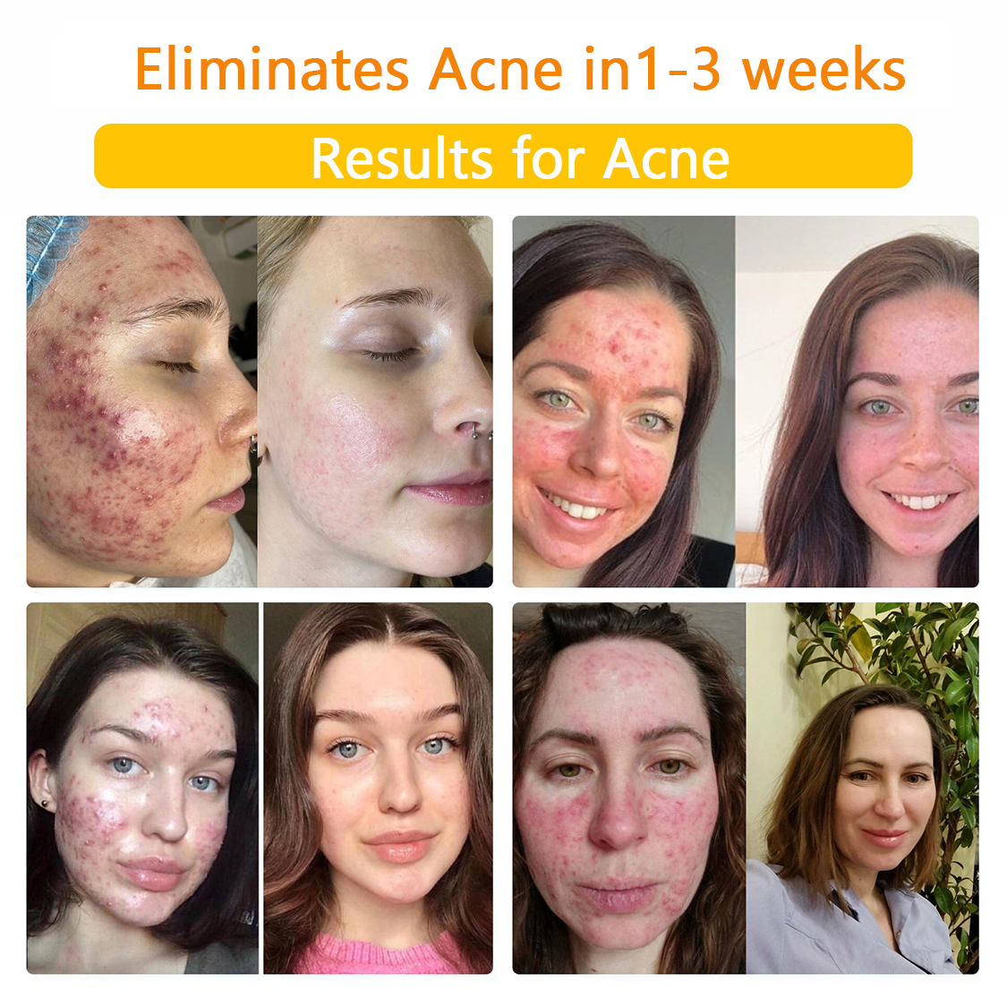 ๐๐๐๐ข๐๐๐๐ขโข Bee Venom Skin Treatment Cream๏ผ๐ด๐ด๐ท ๐
๐๐๐๐๐๐๐๐๐๐๏ผ๐