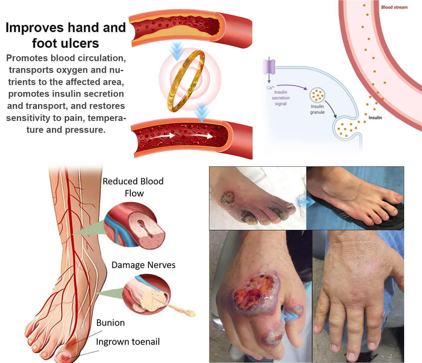 Last Day Promotion 80% OFF š„CZTICLE Lymphatic Magnetic Therapy Catās Eye Ringš„