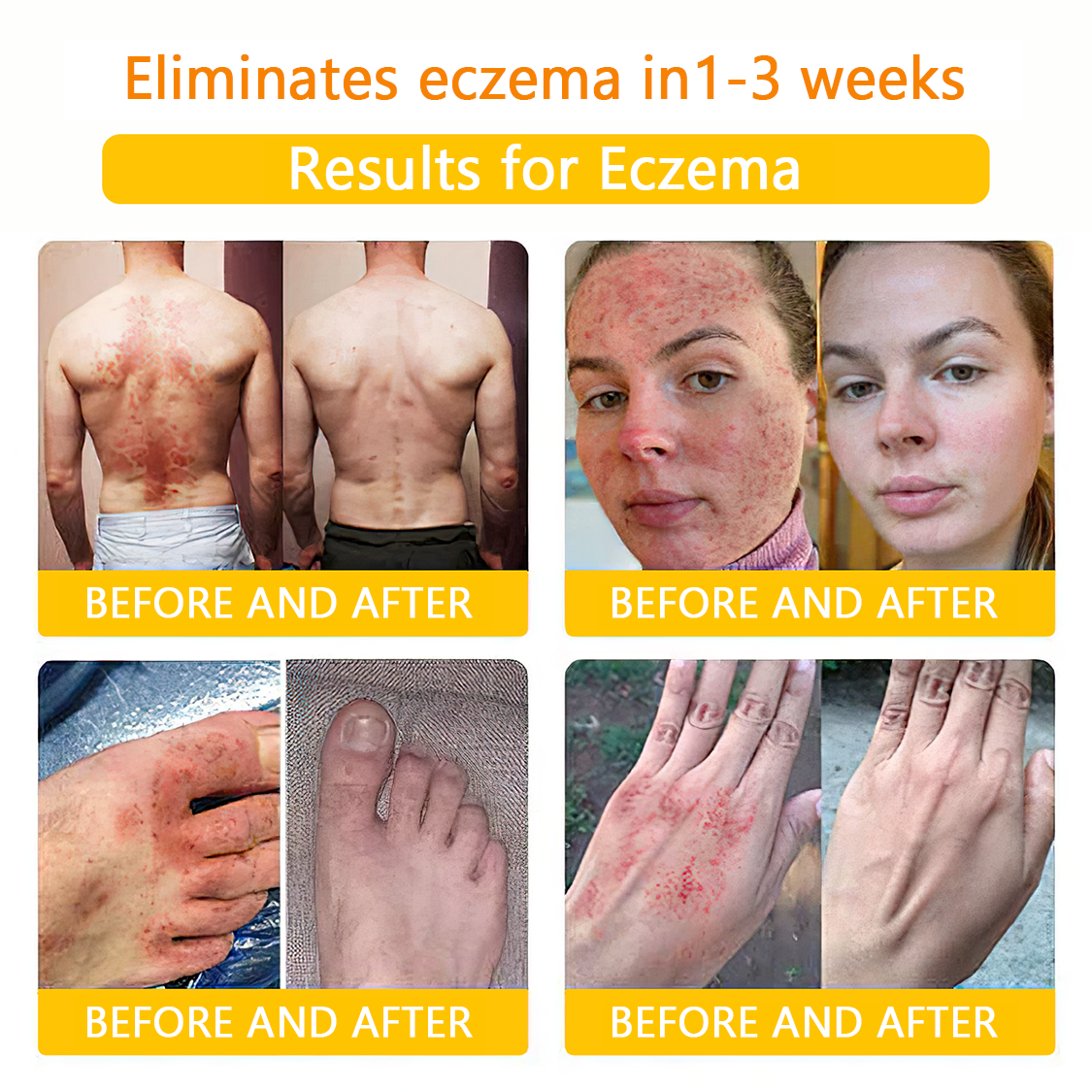 ๐๐๐๐ข๐๐๐๐ขโข Bee Venom Skin Treatment Cream๏ผ๐ด๐ด๐ท ๐
๐๐๐๐๐๐๐๐๐๐๏ผ๐