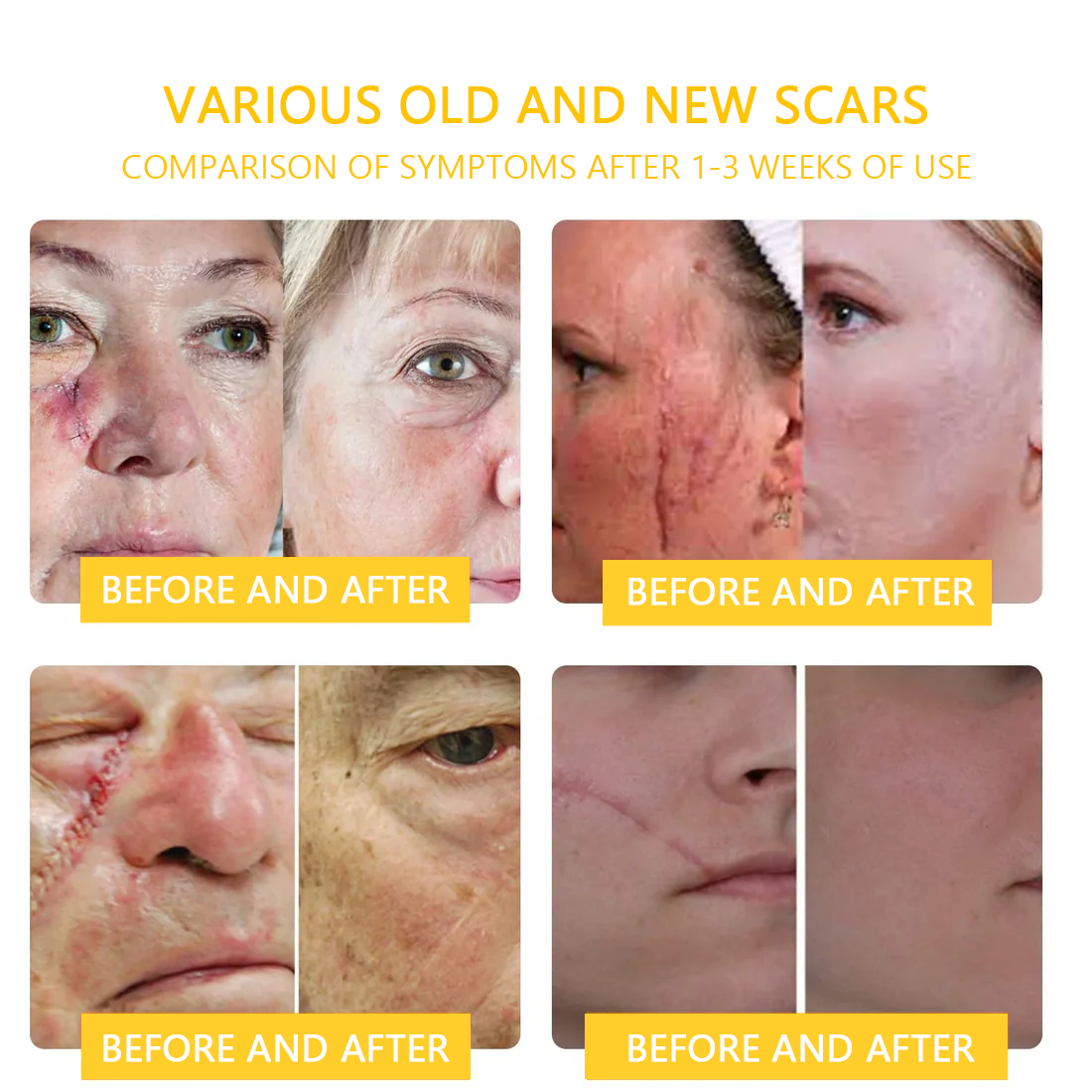 ๐๐๐๐ข๐๐๐๐ขโข Bee Venom Skin Treatment Cream๏ผ๐ด๐ด๐ท ๐
๐๐๐๐๐๐๐๐๐๐๏ผ๐