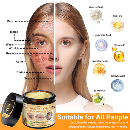 [Official Brand Store] ✅ Lenaro™ Bee Venom All-in-One Cream US Dermatologist Approved (👩‍⚕️ American Academy of Dermatology 2025 Specially Recommended Product) 🎉