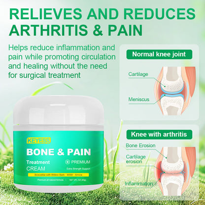 KEYESS® Organic Boswellia Bone&Pain Treatment Cream🍀𝐒𝐩𝐞𝐜𝐢𝐚𝐥𝐢𝐳𝐢𝐧𝐠 𝐢𝐧 𝐨𝐫𝐭𝐡𝐨𝐩𝐞𝐝𝐢𝐜 𝐜𝐨𝐧𝐝𝐢𝐭𝐢𝐨𝐧𝐬 𝐚𝐧𝐝 𝐩𝐚𝐢𝐧👩‍🔬