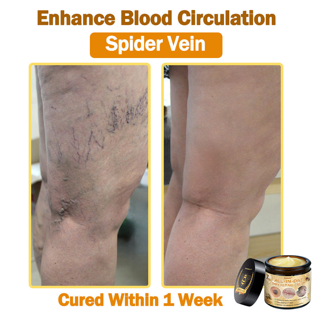 [Official Brand Store] ✅ Lenaro™ Bee Venom All-in-One Cream US Dermatologist Approved (👩‍⚕️ American Academy of Dermatology 2025 Specially Recommended Product) 🎉