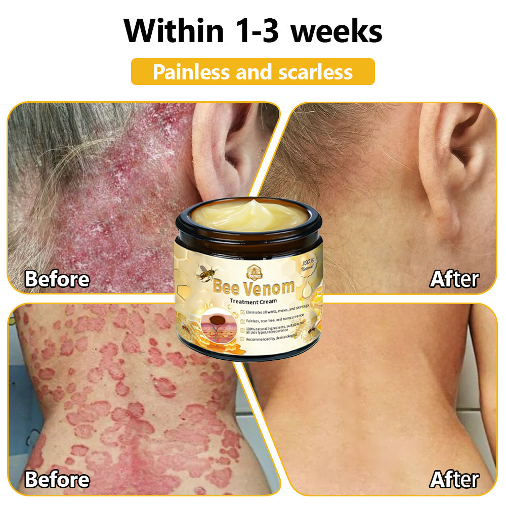 BSWELL™ Bee Venom Skin Treatment Cream (AAD Recommended)