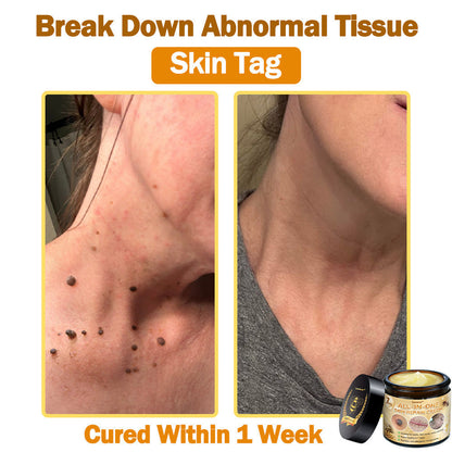 [Official Brand Store] ✅ Lenaro™ Bee Venom All-in-One Cream US Dermatologist Approved (👩‍⚕️ American Academy of Dermatology 2025 Specially Recommended Product) 🎉